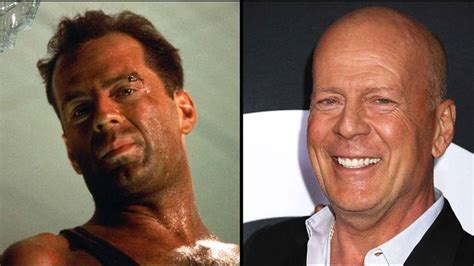 bruce willis what type of aphasia